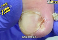 修理小姐姐的脚趾甲动漫,小姐姐脚趾甲的华丽修复之旅